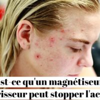 Est-ce qu'un magnétiseur guérisseur peut stopper l'acné ?